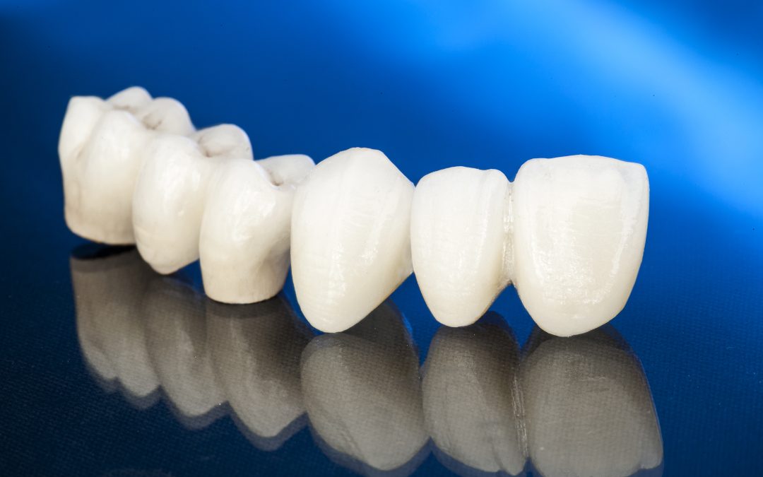 Understanding Dental Crowns: Main Functions