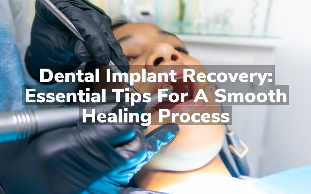 Dental Implant Recovery: Essential Tips for a Smooth Healing Process