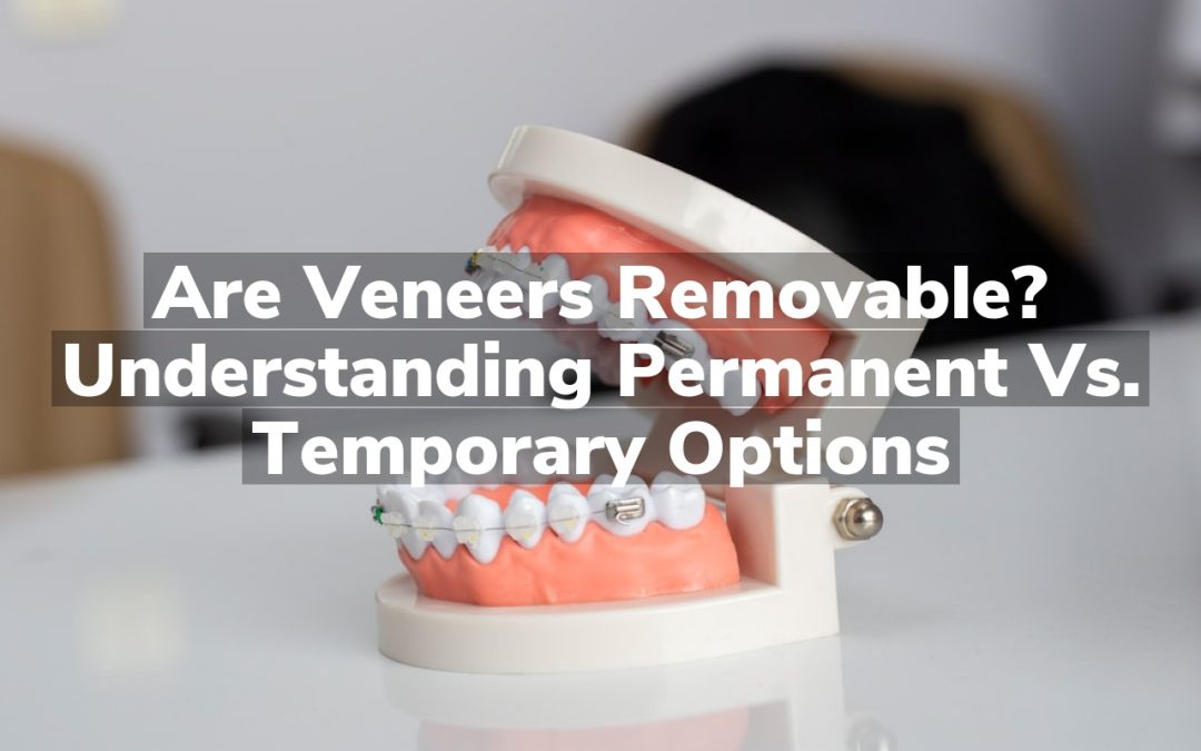 Are Dental Veneers Removable? Understanding Permanent vs. Temporary Options