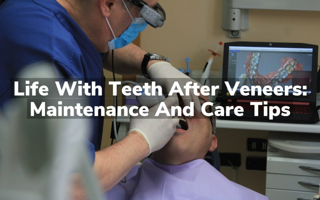 Life with Teeth After Dental Veneers: Maintenance and Care Tips